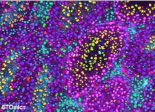 Stereo-seq Transcriptomics mIF Solution